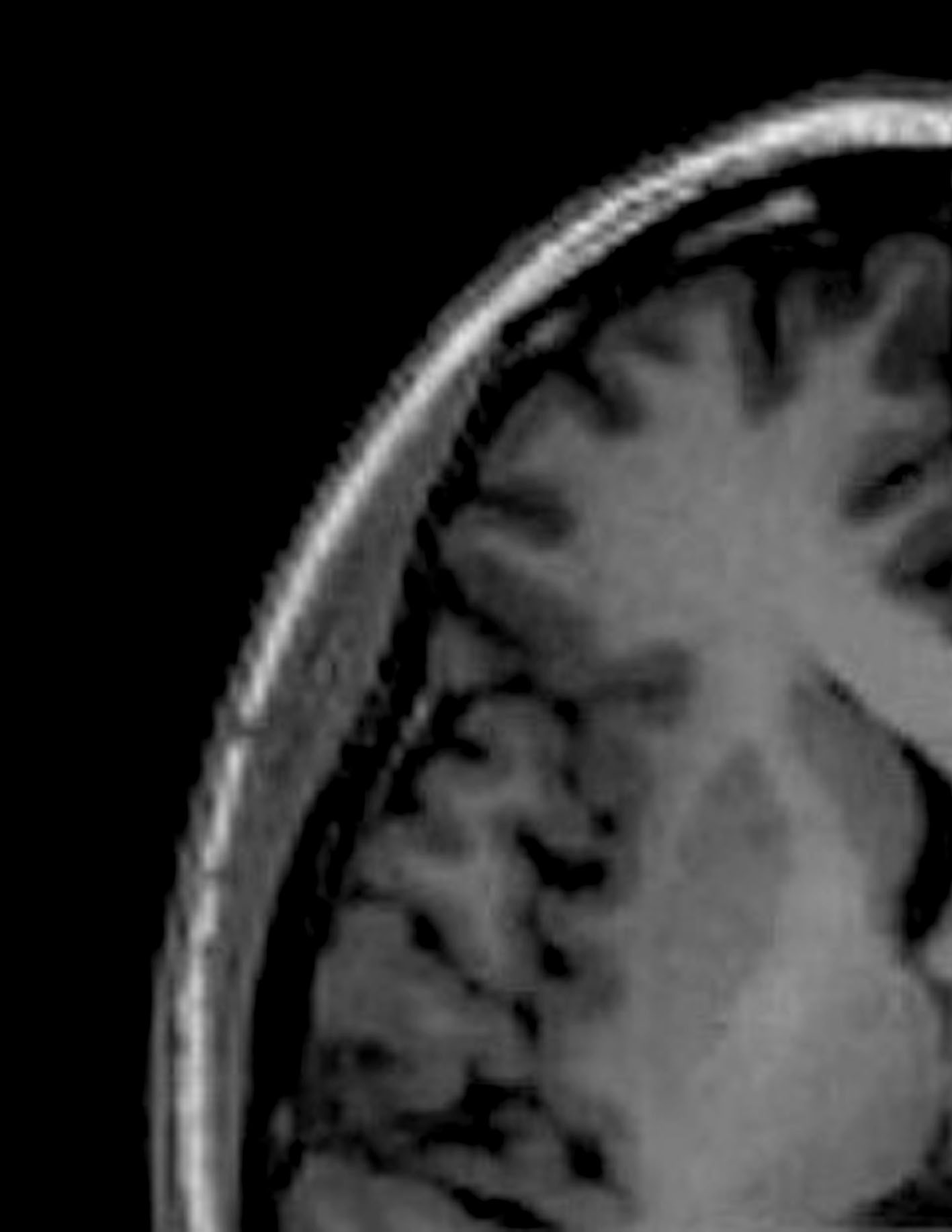 Jane Elizabeth Bennett MRI Scan